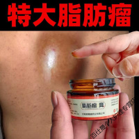 脂肪瘤去除神i器消瘤膏贴全身去皮下脂肪瘤去除硬块保健膏