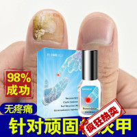 严尔康灰甲灵灰指甲专用甲指生源膏国西甲本灵西林严尔康灰甲灵