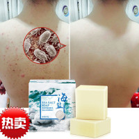 男士洗脸皂去|螨虫去|粉刺海盐香皂杀面部男女全身抗后背止痒菌