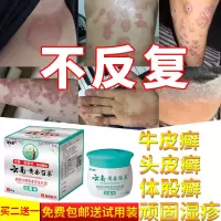 本维莫德乳膏鲜银屑手足股藓湿s疹止痒去根断根皮肤专用外用真菌感染y膏