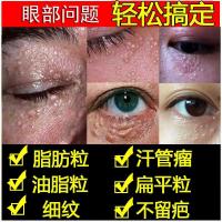 望风舒堂舒颜膏祛脂肪粒去除去油脂粒消除膏眼睛眼部眼角眼霜