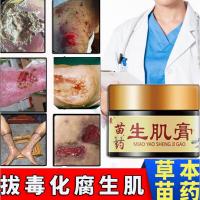 褥疮膏拔之毒去i腐生i肌膏老烂腿压疮清创伤口yao老人护理