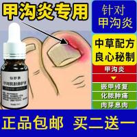 岐甲沟净仙妙肤甲周肌肤修复液治甲沟红肿疼痛镇痛消肉芽化脓指甲扎肉痛