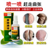 [喷雾]消静i脉曲张膏蚯蚓腿下肢青筋凸起腿部肿胀静脉炎专用膏箹[买2+1]
