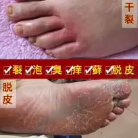 脚底皮 脚部护理膏脚趾缝裂开脚上起水泡脚底皮手起皮痒润肤膏