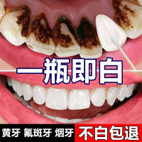 牙变白牙牙齿变去牙牙斑净牙渍烟渍洗白去洗牙粉牙贴洁液