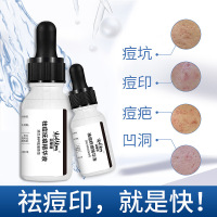 祛痘精华原液祛痘青春痘去粉刺白头黑头紧致肌肤修复肌肤
