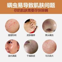 美白祛痘洗面奶男女学生洗脸香皂去除螨虫黑头手工皂。