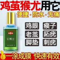 U博士疣瘊净鸡眼膏液去除肉刺瘊子猴子去疣灵脚跖疣膏足部血胞刺