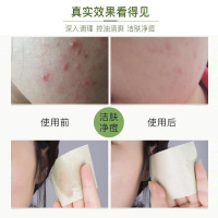 水杨酸棉片去闭口粉刺收缩毛孔刷酸清洁祛黑头面膜男女贴淡化痘印 水杨酸棉片(绿色)