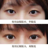 魅力眼廓精油眼角双眼皮大眼精油护理细纹黑眼圈眼部精华油补水保湿提拉紧致眼袋黑眼圈