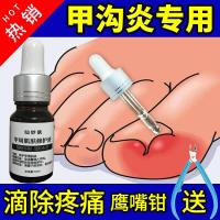 治甲沟炎嵌甲镇痛甲沟红肿疼痛消肉芽化脓走路指甲扎肉痛仙妙肤