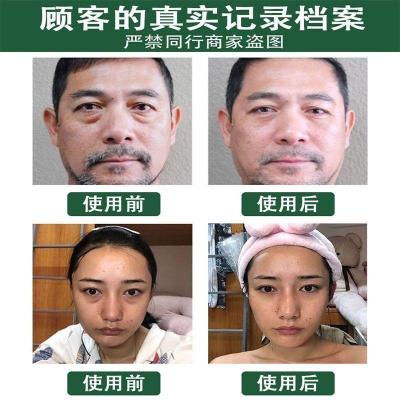 鱼子酱眼霜强效眼霜眼袋皱纹黑眼圈脂肪粒水肿鱼尾法令抬头纹