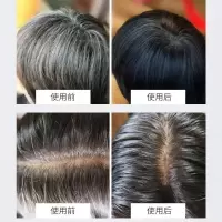 何首乌洗发皂旱金莲迷迭香洗发皂控油去屑净螨防脱洗发水黑芝ma白头黑发男女洗头皂无硅油植物精油手工皂