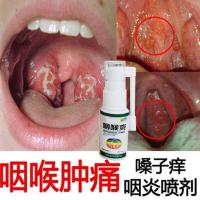 咽喉爽喷雾治烟喉咽炎 治慢性咽炎咽喉炎喷剂异物感滤泡增生有化痰茶喷剂
