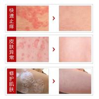 丁氏草本膏丁氏草本抑箘膏成人顽固性止i痒特i效抗过敏无