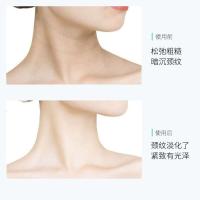 去颈纹按摩仪 双滚轮v型美颈霜去颈纹神i器消除颈纹修复霜护颈霜脖颈霜提拉紧致按摩脖子颈膜