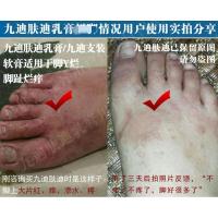 男人下身蛋蛋人下面痒止痒私处妇科男人下面痒男士下身蛋蛋痒氧膏女性股体鲜藓