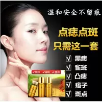 面部无痕点斑水雀斑干点痣水苍蝇屎黑点家用痣的黑痣齐独 白色 慕容雪点痣套装 +牙签