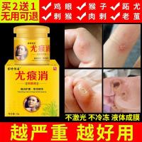 尤瘊消草本精华膏买二贝曾一尤体克星除尤净草本面上眼部脖子腋下手足跖丝疣