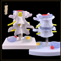!人体腰椎间盘演示模型 腰椎模型 脊柱模型 脊椎模型关节模型 二节病理腰椎带病变