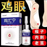 治鸡眼跖疣寻常疣瘊子去刺猴子肉刺鸡眼膏病毒疣拓疣去疣灵特效