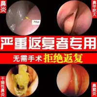 鼻炎一喷灵特效鼻炎克星过敏性鼻炎喷剂喷雾鼻塞鼻甲肥大鼻窦炎