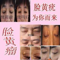 草本去除黄脸眼部面治丝状疣脂肪粒瘊子肉刺汗管扁平笔脸克尤膏