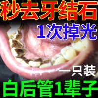 [刷掉牙石不管用退全款]去除重度牙结石牙垢去黄牙结石牙膏强力 套餐a*牙结石一刷就没了*1呮装