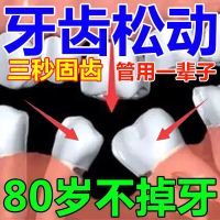 [3天冶好] 牙齿松动固齿牙龈萎缩修复牙缝宽牙齿敏感护龈修复膏 一盒[护齿专家]