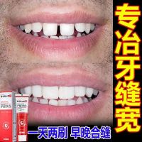 牙缝宽大[当天合缝]修复牙龈萎缩牙齿松动牙齿敏感固齿牙痛牙膏