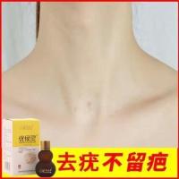 [无疤去疣]脖子小肉粒颈部赘皮赘草温和不留疤丝状尤腋下小猴子 一盒装