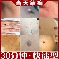 [优选好货]点祛疣必治扁平疣日本去疣灵病毒疣体去除神器专用药膏一抹灵正品