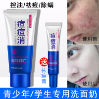 [优选好货]青少年洗面奶去螨虫儿童9岁以上女 控油 祛痘 学生12岁去痘男