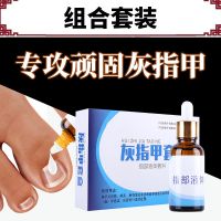 【优选好货】【去灰指甲】灰指甲专用软甲脱甲去坏甲增厚膏亮甲抑菌液