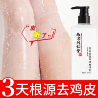 [优选好货][已帮10万人去鸡皮]果酸身体乳保湿补水止痒鱼鳞烟酰胺男女