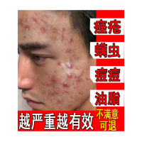 [优选好货]水杨酸祛痘洗面奶虫脸部清洁控油氨基男士专用收缩毛孔学生女