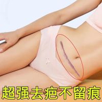 [优选好货][疤痕一抹消]去疤膏烫伤摔伤抓伤疤痕痘印剖腹产修复增生疤痕