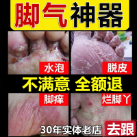 [优选好货]除喷剂止痒脱皮水泡型脚臭粉脚痒膏脚烂脚丫泡脚臭脚喷雾