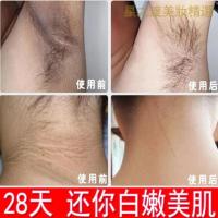 [优选好货]关节腋下去黑去黑色素沉淀手肘膝盖全身屁股黑坐印去除按摩膏