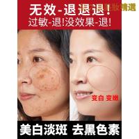 [优选好货]祛斑霜淡斑去黑色素色斑强力去斑祛褐斑雀斑神器