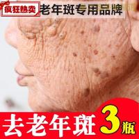 [优选好货]除祛斑专祛老年斑手部脸部抹去老年斑的药祛斑霜手背专用药神器