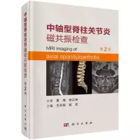 中轴型脊柱关节炎磁共振检查(第2版)王炎焱,赵征R