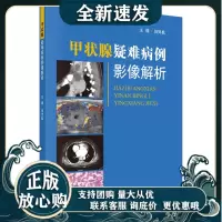 甲状腺疑难病例影像解析/田兴松R