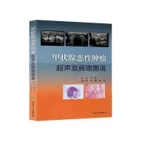 [有货]甲状腺恶性肿瘤超声及病理图谱