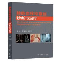 静脉血栓栓塞症诊断与治疗 临床常见疾病病理生理学临床诊治