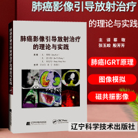 肺癌影像引导放射治疗的理论与实践 蔡敬 医药 卫生书籍 治疗计划设计治疗计划的进展肺癌的自适应放疗 辽宁科学技术出版社