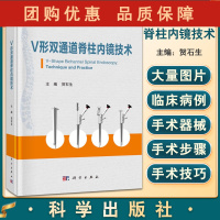 B[正版]V形双通道脊柱内镜技术 介绍设计原理、手术器械、适应证与禁忌症、手术步骤与手术技巧等 贺石生 编9787030
