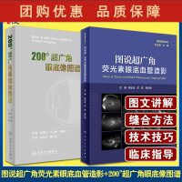 B[正版] 图说超广角荧光素眼底血管造影+200°超广角眼底像图谱 眼科学书籍基层眼科医师眼底病学医学书参考 人民卫生出