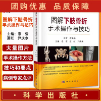 B[正版]图解下肢骨折手术操作与技巧 阐述下肢骨折手术的操作方法和技巧要点 图文并茂 章莹 夏虹 尹庆水 编978703
